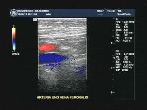 Art. und Vena femoralis
